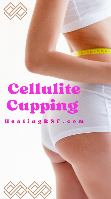 Cupping for Cellulite Reduction: A Natural Approach to Smoother Skin